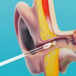 Ear wax Cleaner Stick Silicone Reusable Sticky Ear wax Removal Kit (12 Pcs Set) - Closeup Embroidery by Nari Haat, In...