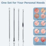 Blackhead Remover, 4-in-1 Stainless Steel Pimple Extractor Tool (1 Pc) - Closeup Embroidery by Nari Haat, Indian ethn...