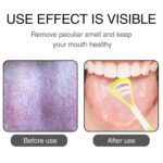 Oral Tongue Cleaner – Stainless Steel Scraper for Personal Dental Care - Closeup Embroidery by Nari Haat, Indian et...