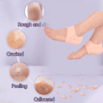 Anti Crack Silicone Half Gel Heel And Foot Protector Moisturizing Socks - With Dupatta by Nari Haat, Indian ethnic we...