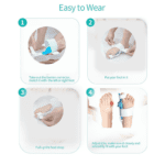 Adjustable Bunion Support Splint – Hallux Valgus Corrector for Men & Women - Closeup Embroidery by Nari Haat, India...