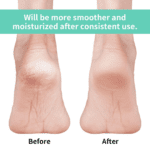 Anti Crack Silicon Gel Heel Moisturizing Socks for Foot Care Men Women (Loose Pack) - Closeup Embroidery by Nari Haat...