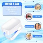 Rechargeable Nail Fungus Laser – Anti-Fungal Device Toenails, Hands & Feet (Home Use) - Full Detail by Nari Haat, I...