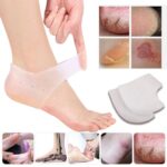 Silicone Gel for Dry Cracked Heels