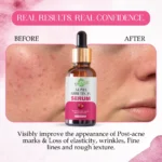 VIGI&GLO Alpha Arbutin 2% Face Serum | Dark Spots, Pigmentation & Glow | Herbal | 30ml - With Dupatta by Smar...