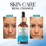 VIGI&GLO Skin Brightening Face Serum | Daily Glow, Even Tone & Brightness | Herbal | 30ml - With Dupatta by S...