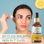 VIGI&GLO Vitamin C 15% Face Serum for Glowing Skin | Dark Spots, Pigmentation & Dullness | Herbal | 30ml - Wi...