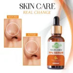 VIGI&GLO Niacinamide 10% Face Serum | Acne Marks, Oil Control & Pore Tightening | Herbal | 30ml - Closeup Emb...