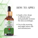 VIGI&GLO Spot Removal Face Serum | Dark Spots, Pigmentation & Acne Marks | Herbal | 30ml - Sleeve Design by S...