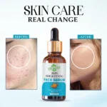 VIGI&GLO Skin Brightening Face Serum | Daily Glow, Even Tone & Brightness | Herbal | 30ml - Closeup Embroider...