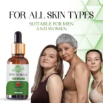 VIGI&GLO Spot Removal Face Serum | Dark Spots, Pigmentation & Acne Marks | Herbal | 30ml - With Dupatta by Sm...