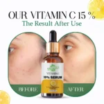VIGI&GLO Vitamin C 15% Face Serum for Glowing Skin | Dark Spots, Pigmentation & Dullness | Herbal | 30ml - Cl...