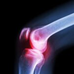 (XL) Knee Cap for Knee Support - Neckline Detail by Nari Haat, Indian ethnic wear, women clothing, designer suit