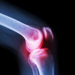 Knee Cap for Knee Support (Large) - Neckline Detail by Nari Haat, Indian ethnic wear, women clothing, designer suit