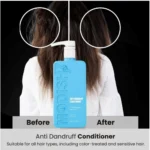 Generic Unisex Protein Anti Dandruff Conditioner (350 ML) - Image 2