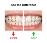 Smart Water Flosser Teeth Cleaner For Cleaning Teeth - Back View by Nari Haat, Indian ethnic wear, women clothing, de...